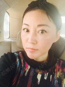 整容后我满血复活了,整容后的我焕然一新